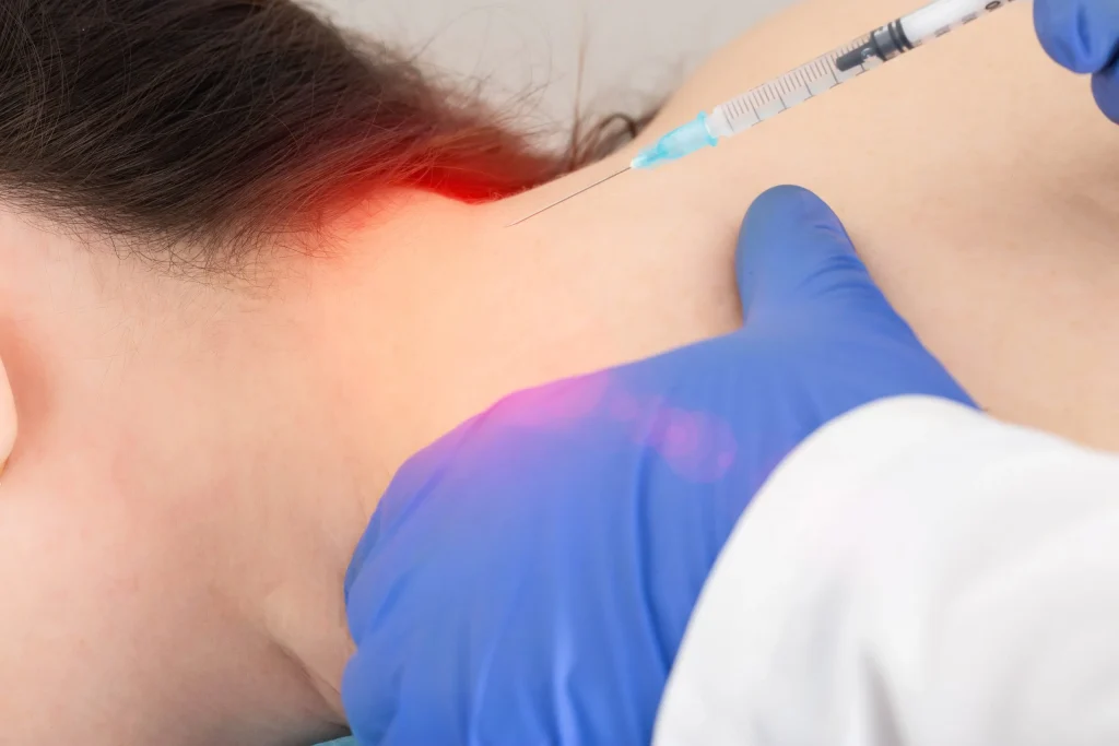 Reducing Migraine Frequency