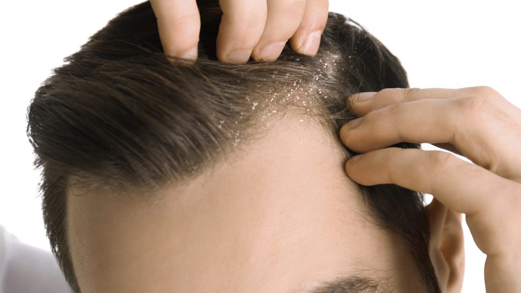 Benefits of Scalp Treatments in Hair Restoration