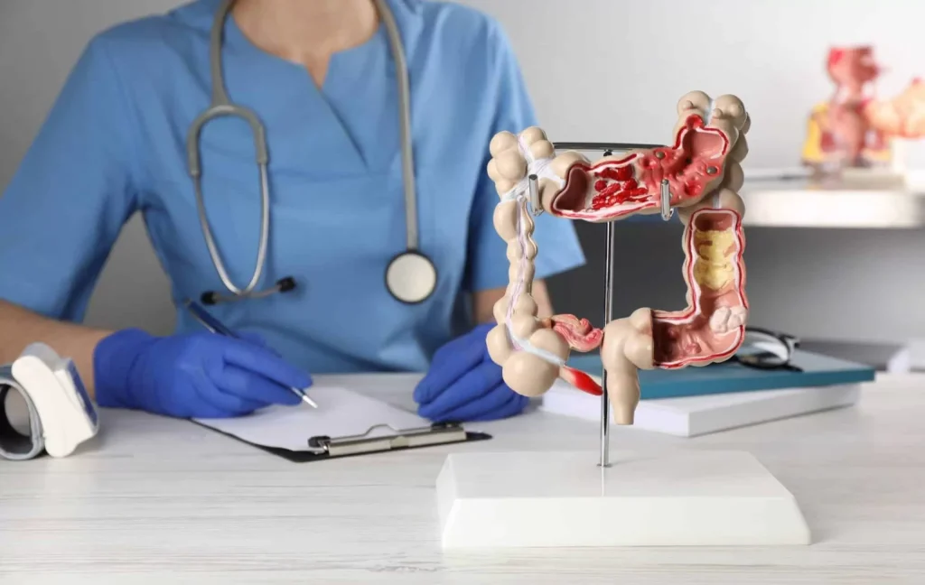 Colon Cancer Surgery