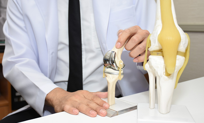 Things to Know Before Undergoing Joint Replacement Surgery Joint Replacement Surgery